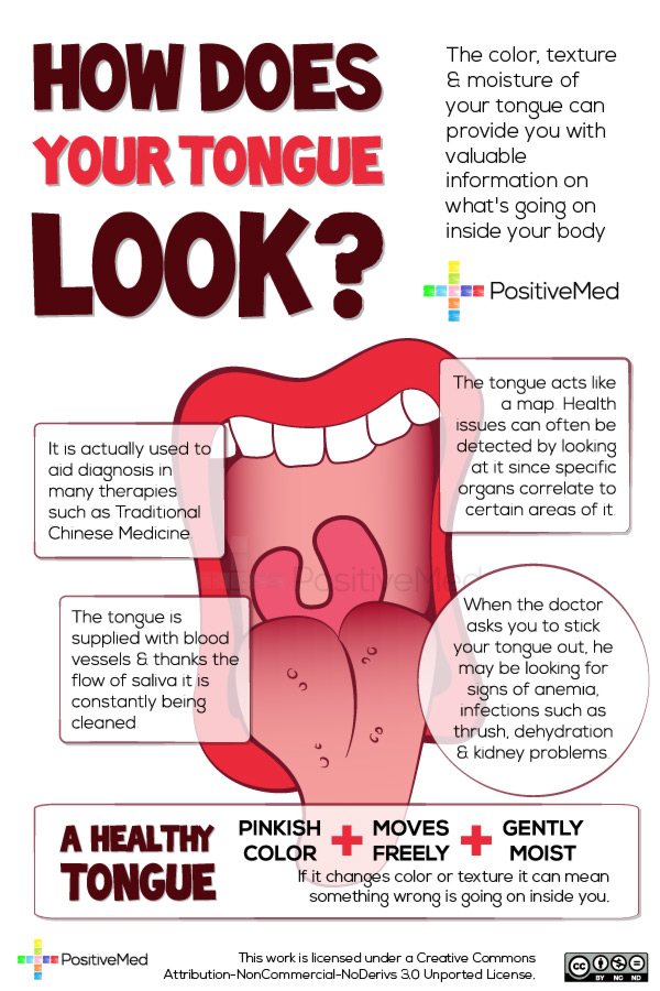 HOW-DOES-YOUR-TONGUE-LOOKWEB